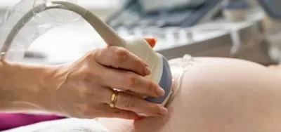 IUI treatment service by IVF doctor in Delhi