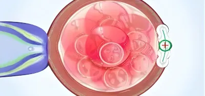 Fertility preservation services at IVF centre in West Delhi