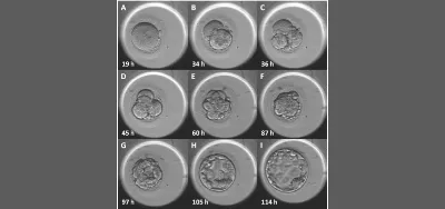 Advanced reproductive technology at IVF hospital in Delhi